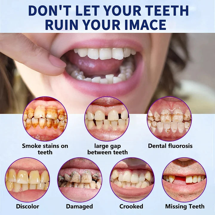 Ewerydays | SmileFitPro – Lösung der neuen Generation: Flexible Vollprothese