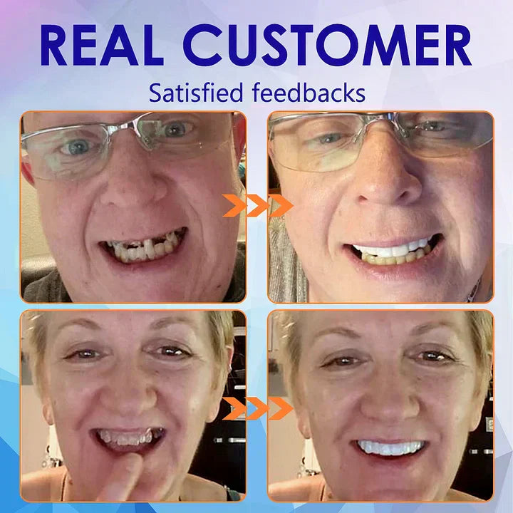 Ewerydays | SmileFitPro – Lösung der neuen Generation: Flexible Vollprothese