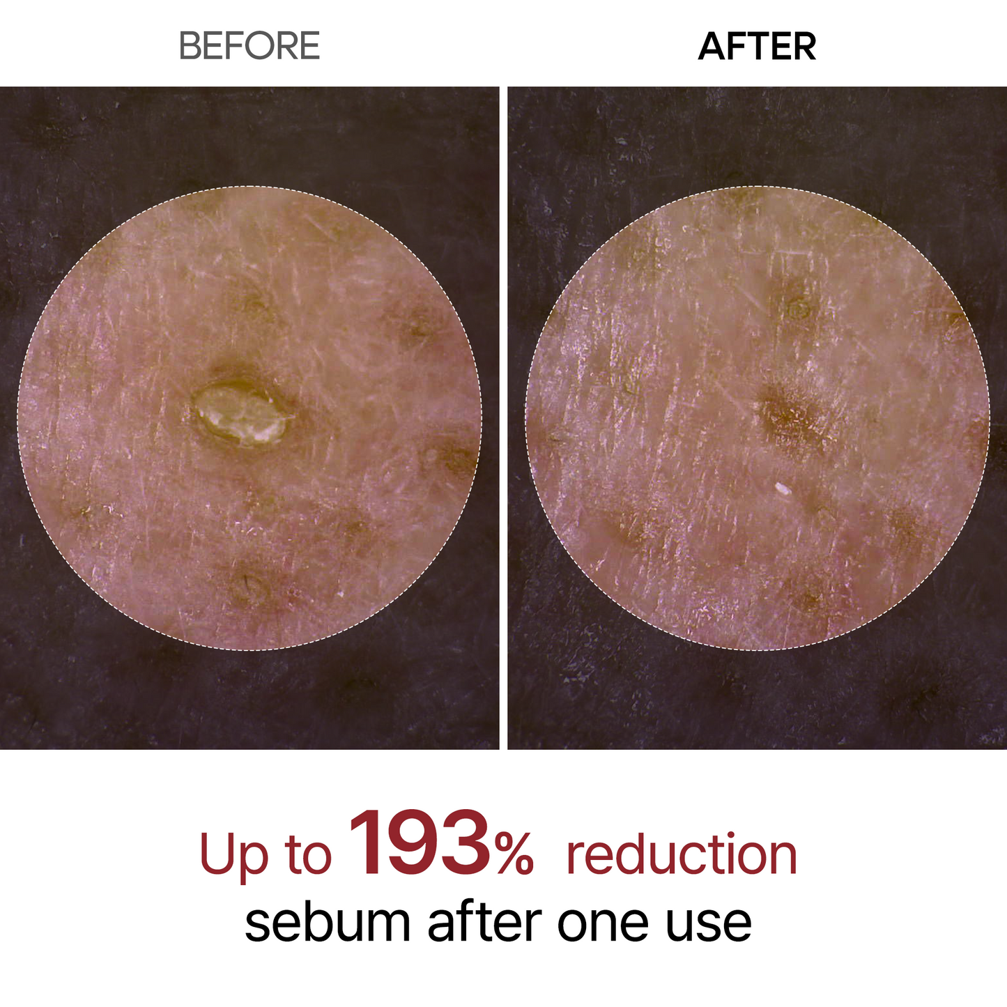 Ewerydays | Peel Shot Glow Reislinie